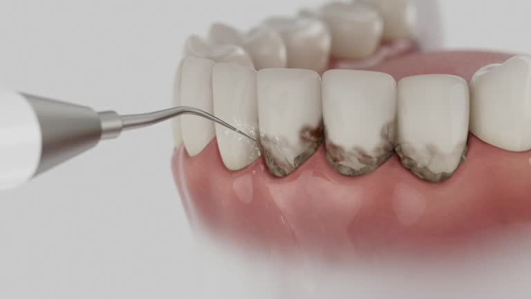 Trusted Wisdom Tooth Removal service in Andale, KS - Dentist Open Now